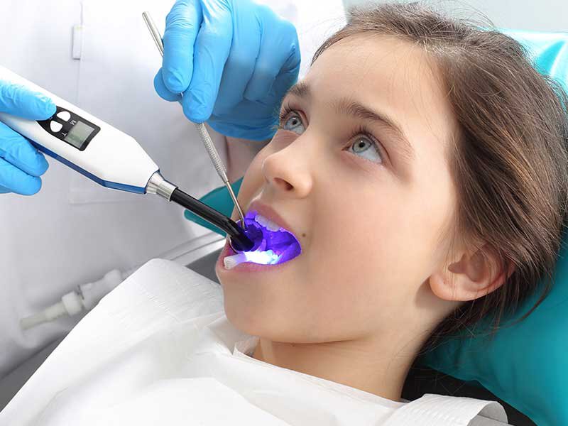 Pediatric Dentistry Dental Fillings